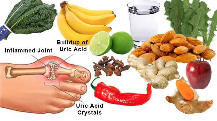 Are Nuts Good For Gout Diet